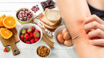 Vad är en matallergi? Vem får matallergier och vilka är symptomen?