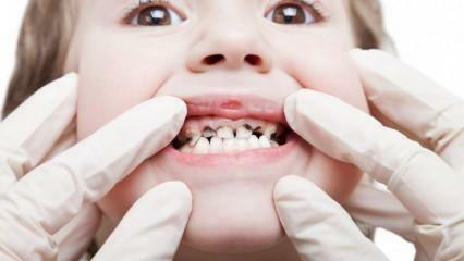 Få ditt barns tandvård gjord under terminen!