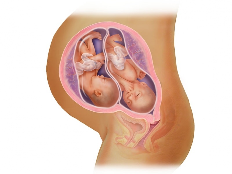 Tvillinggraviditet i IVF! Vad är embryoöverföring?