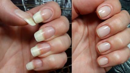 Hur tar man hand om naglar? Snabba nagelförlängningsmetoder
