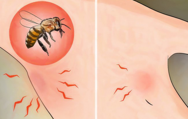 Vad är binallergi och vilka är symptomen? Naturliga metoder som är bra för bi-stick