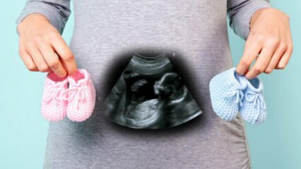 Kommer barnets kön att bestämmas under graviditetens första trimester?