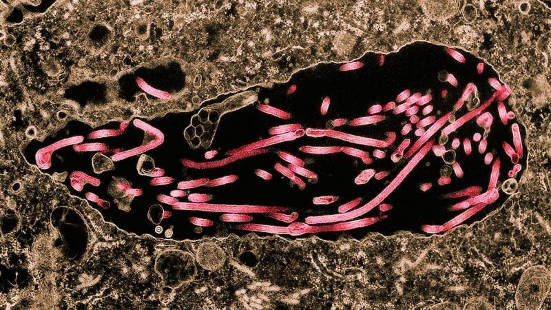 bild av ebolans spridning till celler