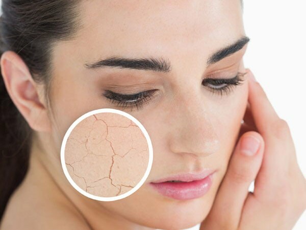 Varför torkar huden? Vad gör man på torr hud? De mest effektiva vårdrekommendationerna för torr hud