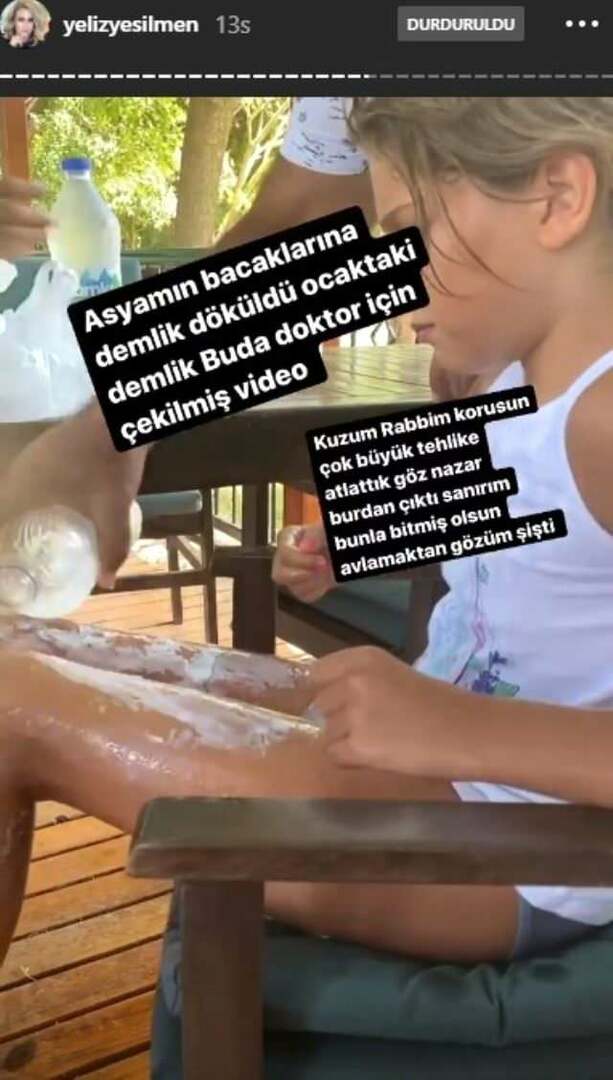 Kokande vatten hälldes på Yeliz Yeşilmens dotters ben