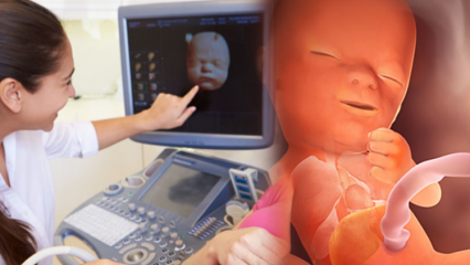 Vilket organ utvecklas först hos spädbarn? Babyutveckling vecka för vecka