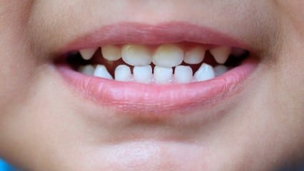 Hur kan man lära barn tandvård?