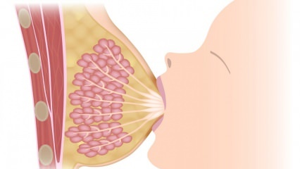 Vad är mastit (bröstinflammation)? Mastit symptom och behandling under amning