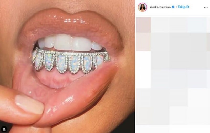 Kim Kardashians tandpärla på 5 000 dollar