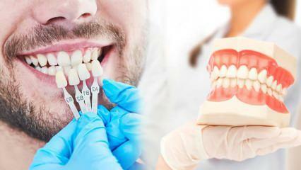 Varför appliceras zirkoniumfaner på tänderna? Hur hållbar är zirkoniumbeläggningen?