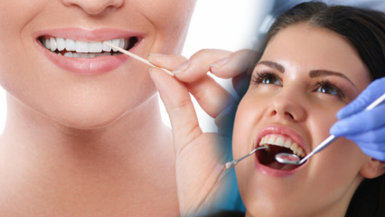 Hur bibehåller man mun- och tandhälsa? Vad ska man tänka på vid rengöring av tänder?