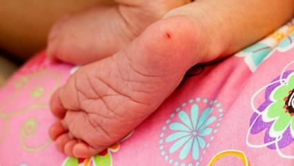 Varför tas hälblod hos spädbarn? Krav för testning av hälblod hos spädbarn