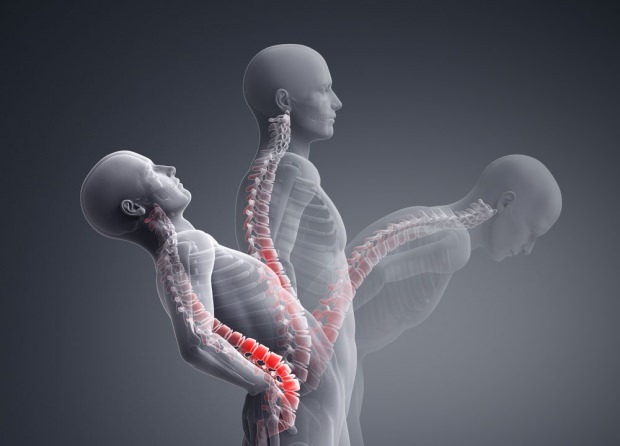 Vad är en ryggkollapsfraktur? Hur är behandlingen av ryggradsbrott?