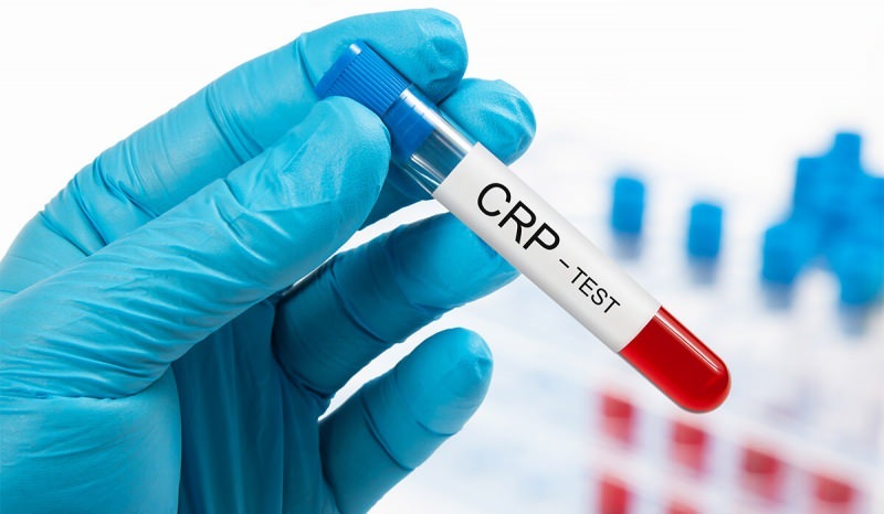 Varför stiger CRP i blodet? Vad är CRP? Hur sänker jag CRP?
