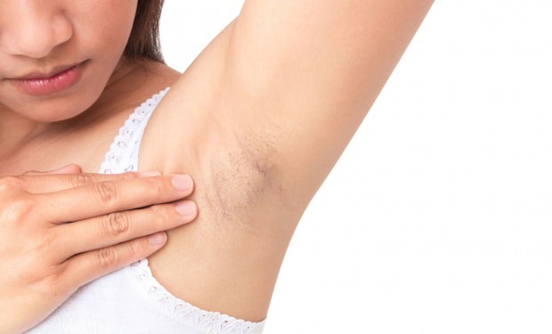 hur försvinnningen av armhålan går