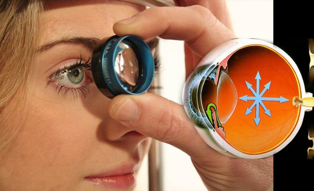 Vad är glaukom? Var uppmärksam på denna sjukdom som fortskrider smygande utan att ge några symtom!