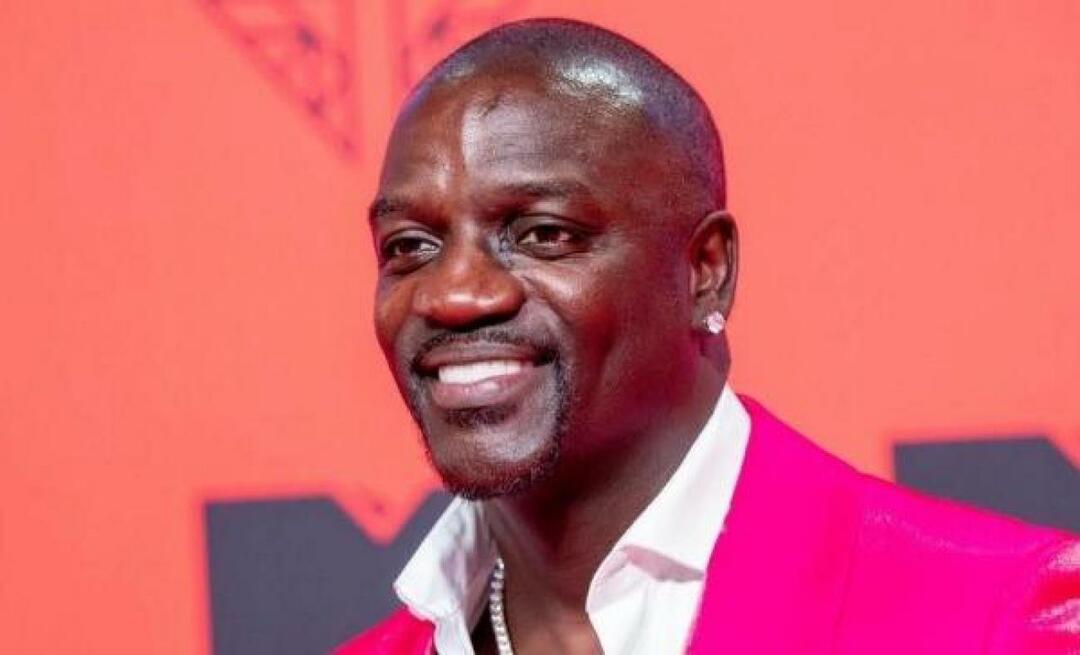 Den amerikanska sångaren Akon föredrog också Turkiet för hårtransplantation! Här är priset han betalade...