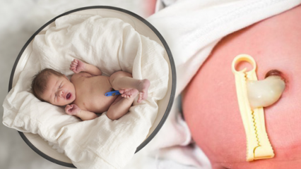 Vad är Placenta Previa? Hur gör man navelstrengsvård hos spädbarn? Om navelsträngen är lång ...