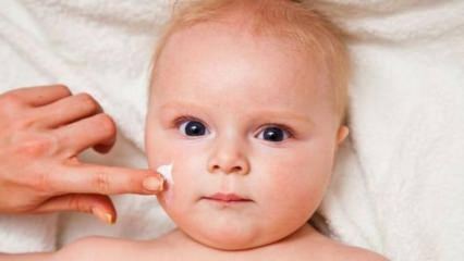Hudvårdstips för spädbarn! Vilka är hudproblemen hos spädbarn?