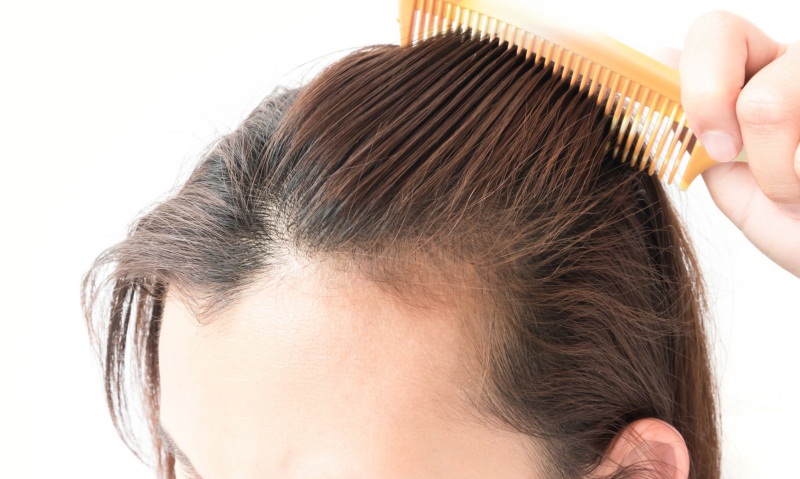 håravfallslösningar efter förlossningen! Vad är bra för håravfall?