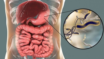 Vad är Helicobacter Pylori (magmikrober)? Sjukdomar orsakade av Helicobacter Pylori ...