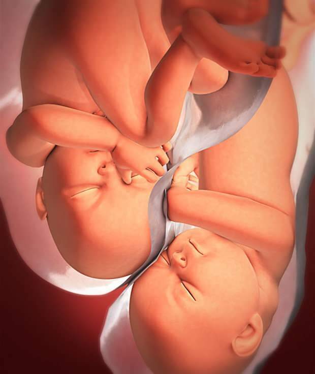 Vilka är symtomen på tvillinggraviditet?