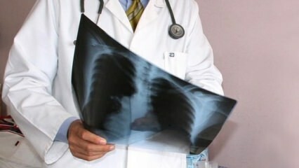 Experter meddelade! Ökning av dödsfall i lungcancer