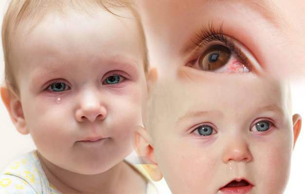 orsakar ögonblödning hos spädbarn