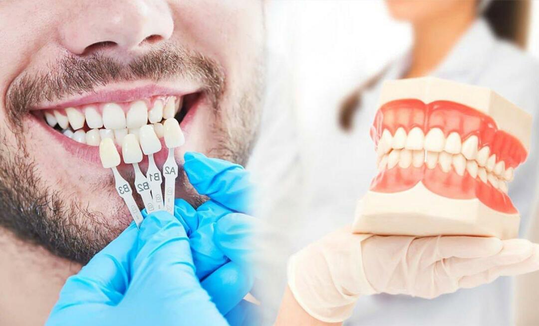 Varför appliceras zirkoniumfaner på tänderna? Hur hållbar är zirkoniumbeläggningen?