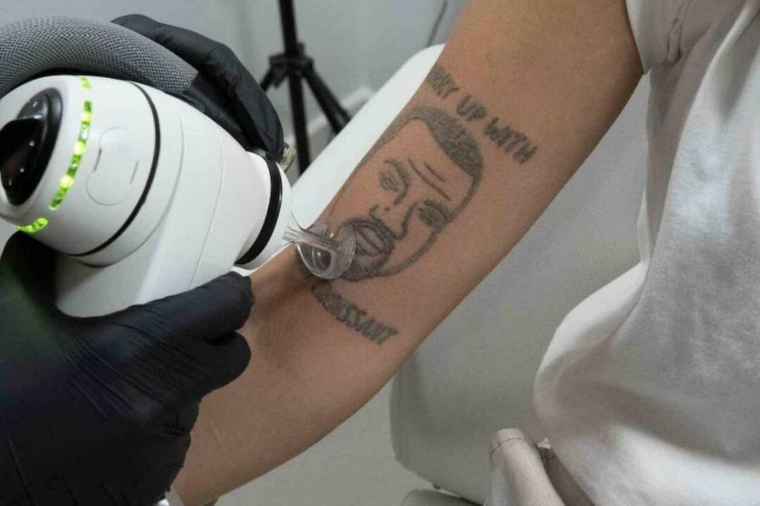 Jätteservice till de som inte gillar Kanye West! Möjligheten att ta bort sin tatuering gratis har gjort oreda