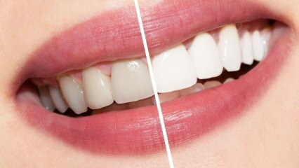 Vilka är rekommendationerna för vita tänder? Tandblekning botar naturligt hemma ...