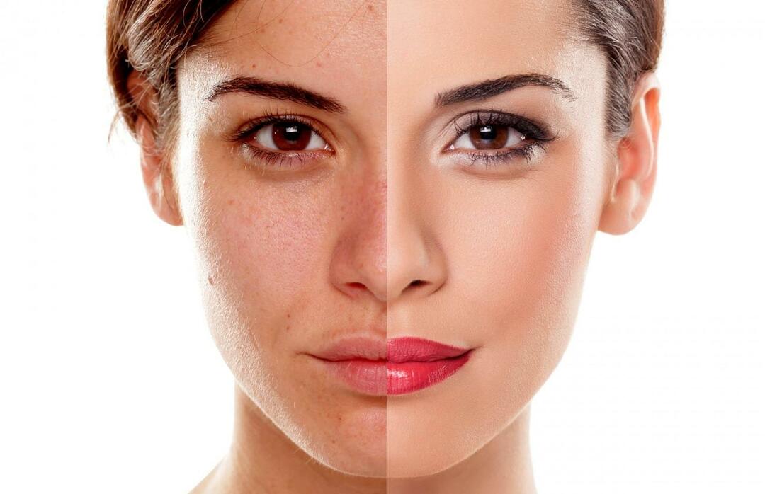 Hur förhindrar vi att huden ser trött ut? Hur minskar man det trötta utseendet på huden?