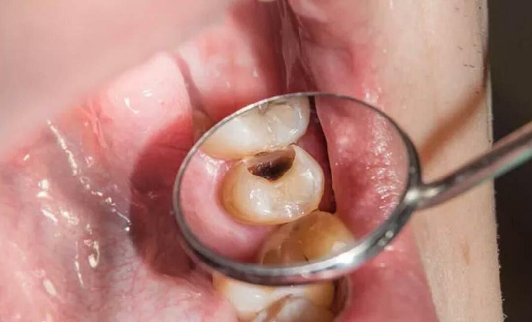 Varför ruttnar tänderna och vad kan vi göra för att förhindra det? 
