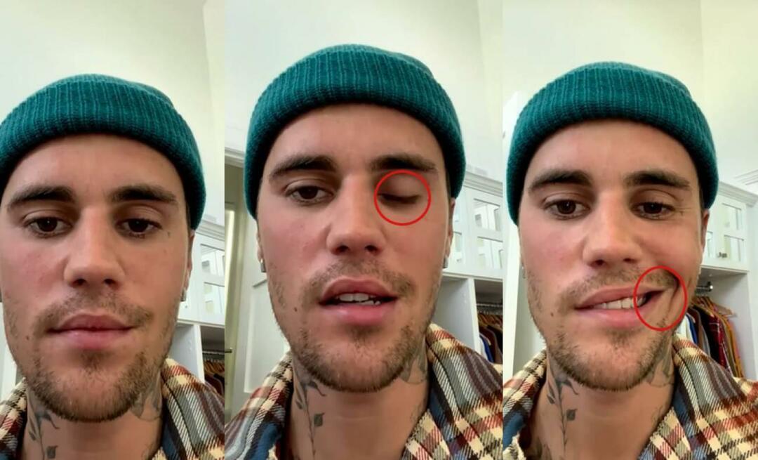 Justin Bieber hade en ansiktsförlamning! Den berömda stjärnan kan inte åka på världsturné igen