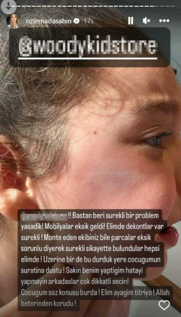 Garderobsdörren föll på Berkay Şahins dotters ansikte