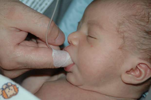 Vad är metoden Finger Feeding? Hur matas barnet med en spruta?