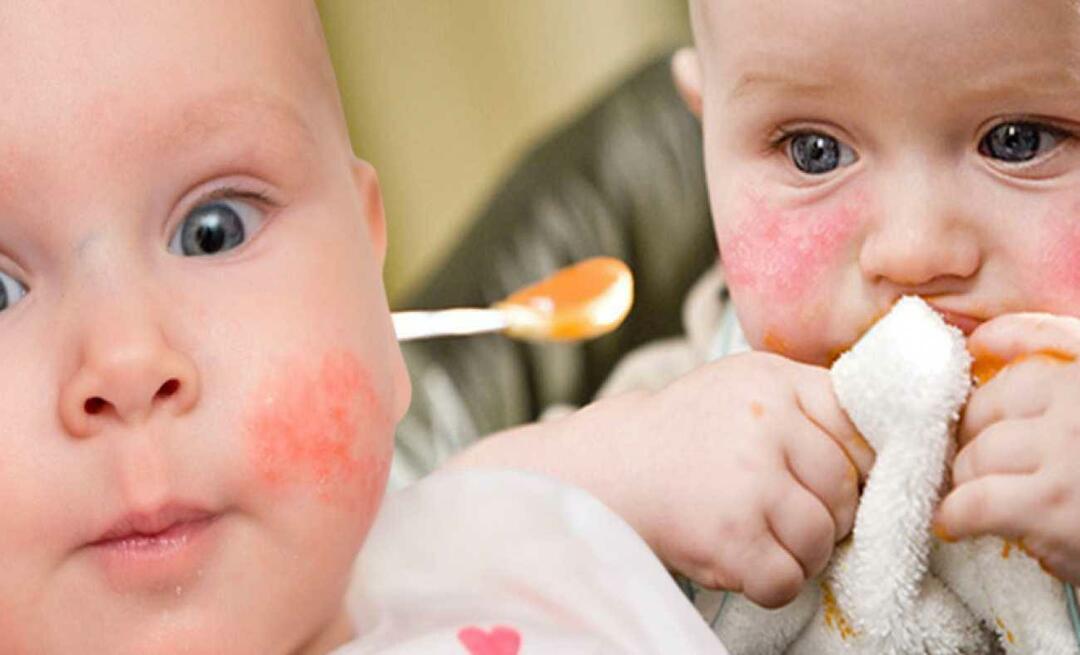 Vad ska ett barn med allergi äta? Vad är alternativ mat för allergiska spädbarn?