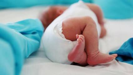 Bör spädbarn ha en ultraljud i höften?