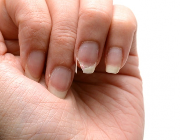 Hur görs nagelvård? Snabba nagelförlängningsmetoder