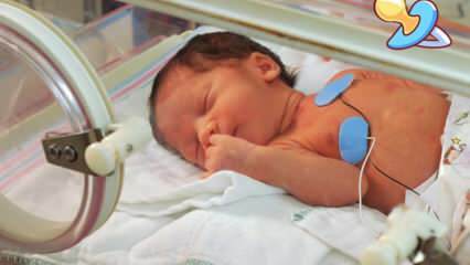 Anledningen till att spädbarn tas i inkubatorn Hur många kilo baby tas i en inkubator? Nyfödda inkubatorfunktioner