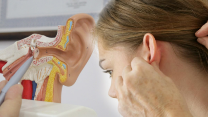 Vad är öronförkalkning (Otoskleros)? Vilka är symtomen på öronförkalkning (Otoskleros)?