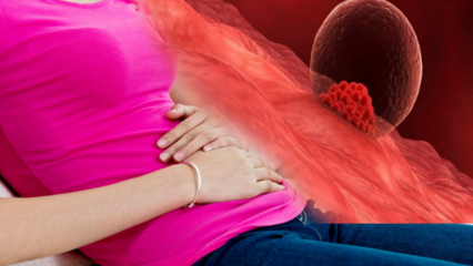 Vad är implantationsblödning under graviditeten? Hur man skiljer implantationsblödning från menstruationsblödning