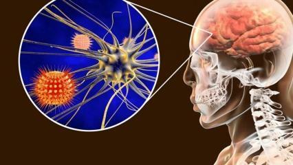 Vad är meningit och vilka är dess symtom? Finns det någon behandling för hjärnhinneinflammation?